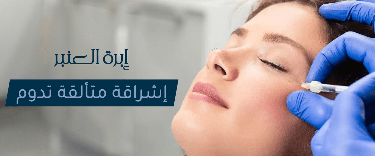 إبرة العنبر