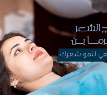 علاج الشعر بديرما بن