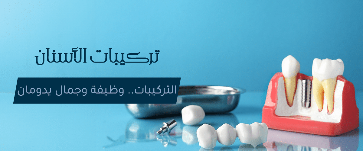 تركيبات الأسنان الثابتة والمتحركة