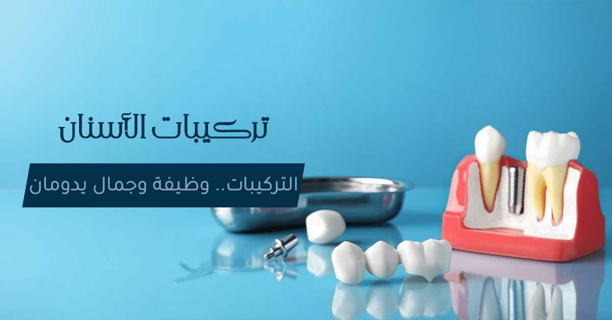 تركيبات الأسنان الثابتة والمتحركة